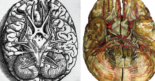 Différentes images de cerveau